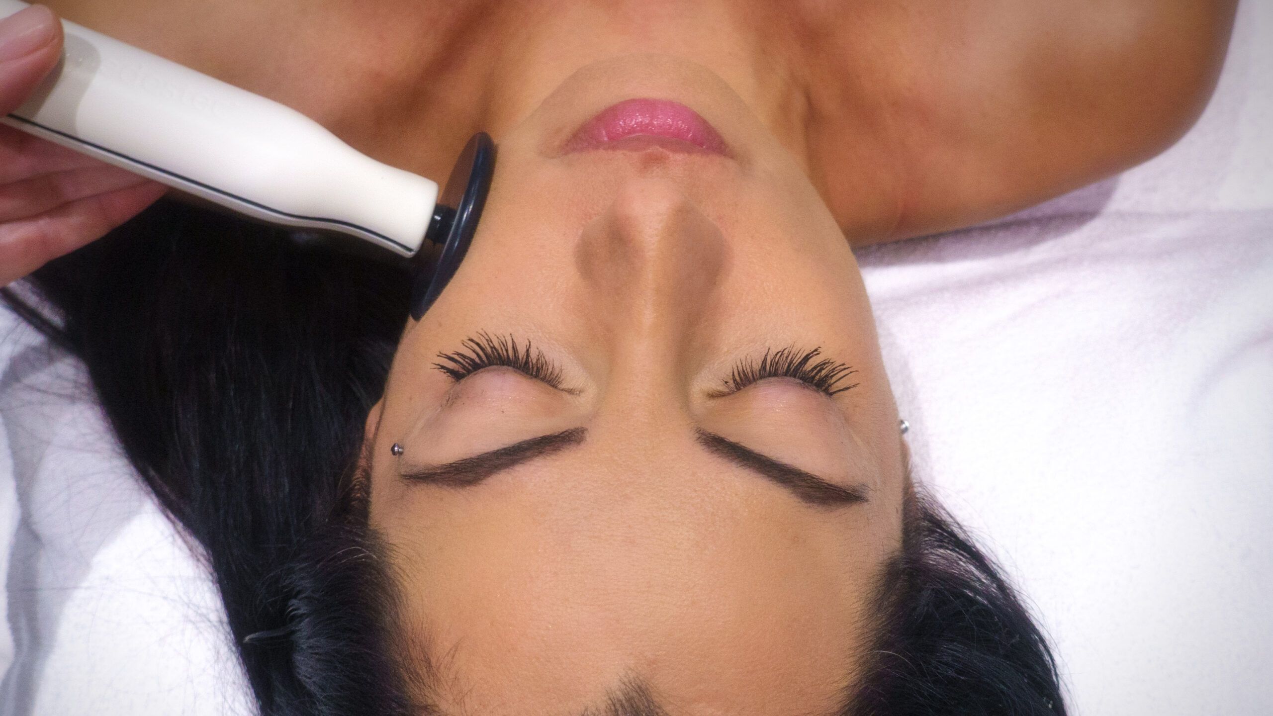 Medical Aesthetic Radiofrequency Treatments