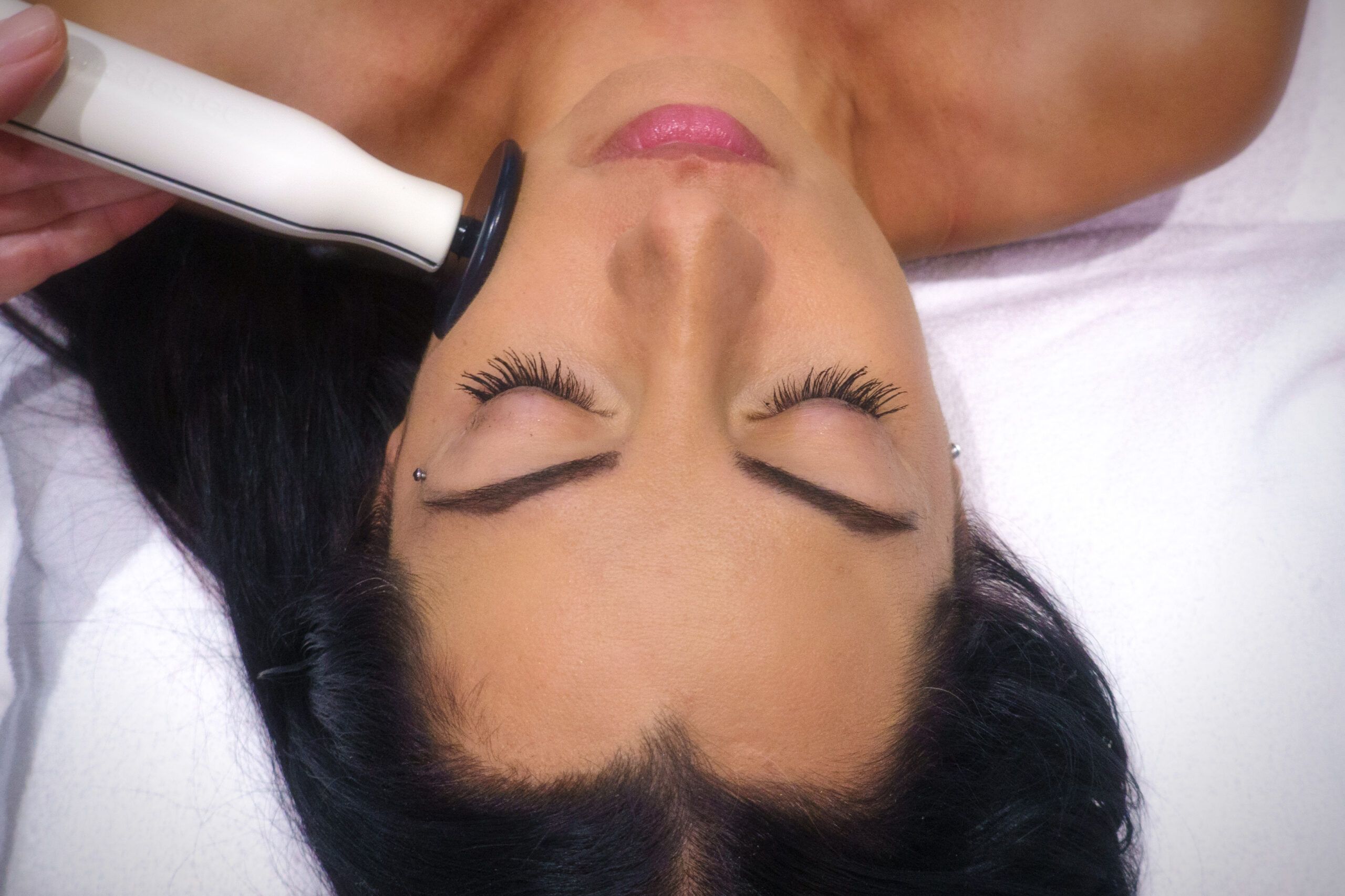 Aesthetic Facial Radiofrequency 